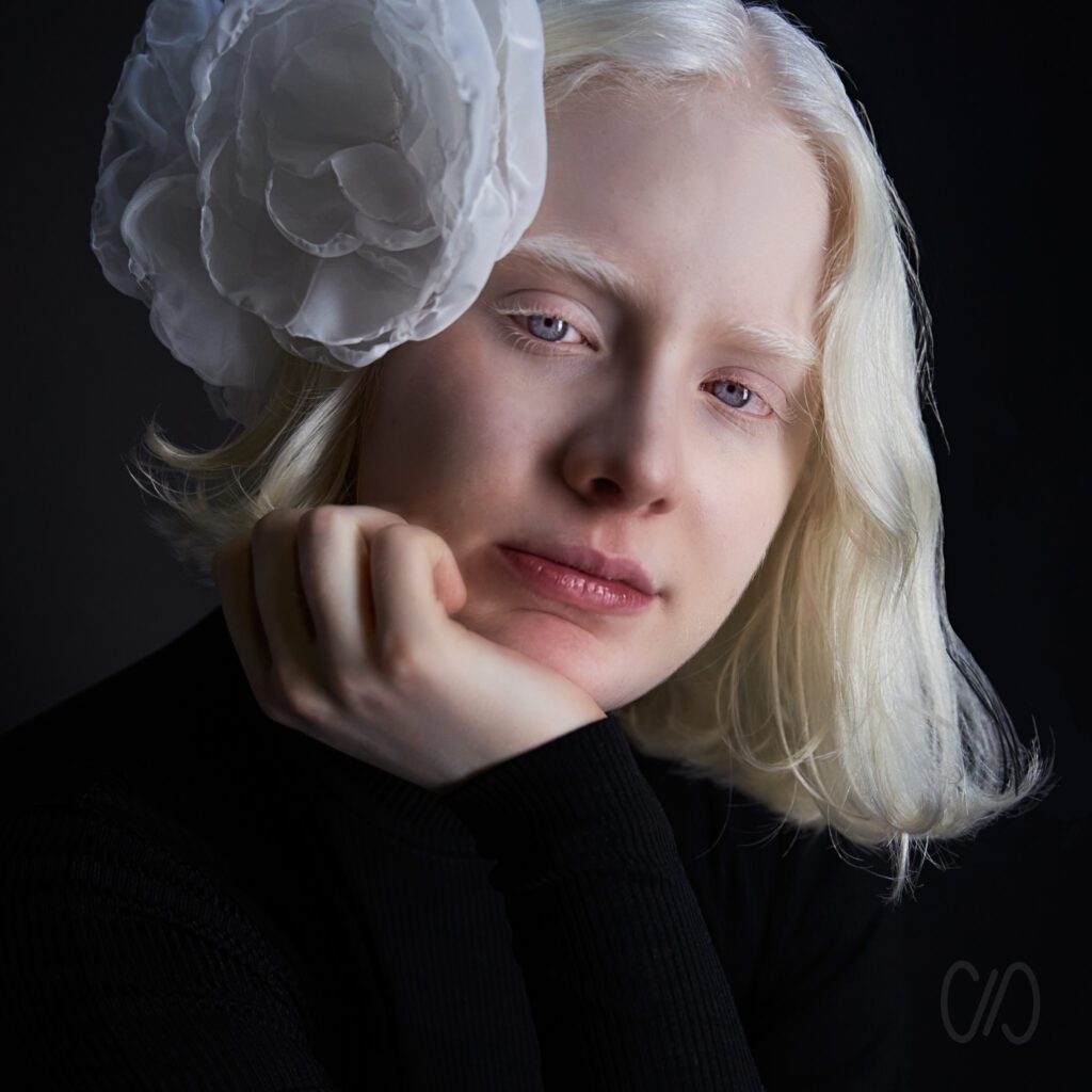 ¿ Cuando usar el Retoque Digital de Piel ? joven albina con flor blanca en el cabello de adorno